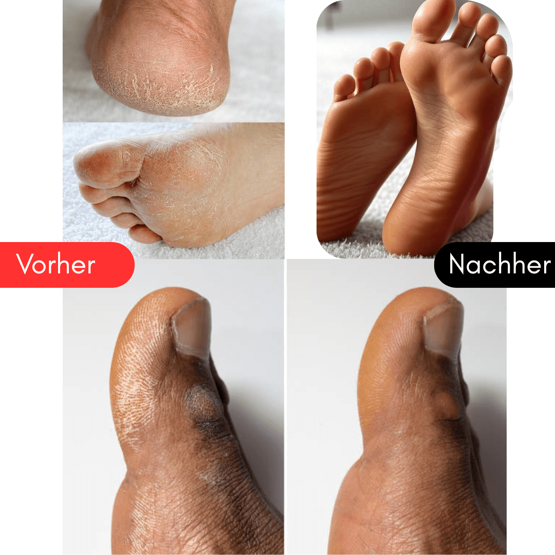 Tivana SoftSchritt – Für weiche Füße, Schritt für Schritt