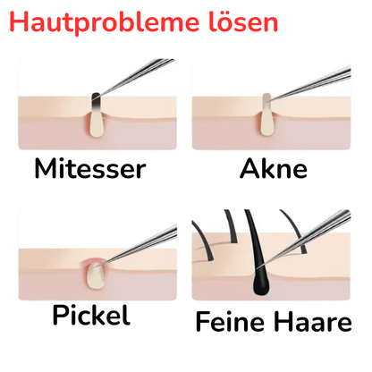 DermaNinja 11 - Akne Meisterkit