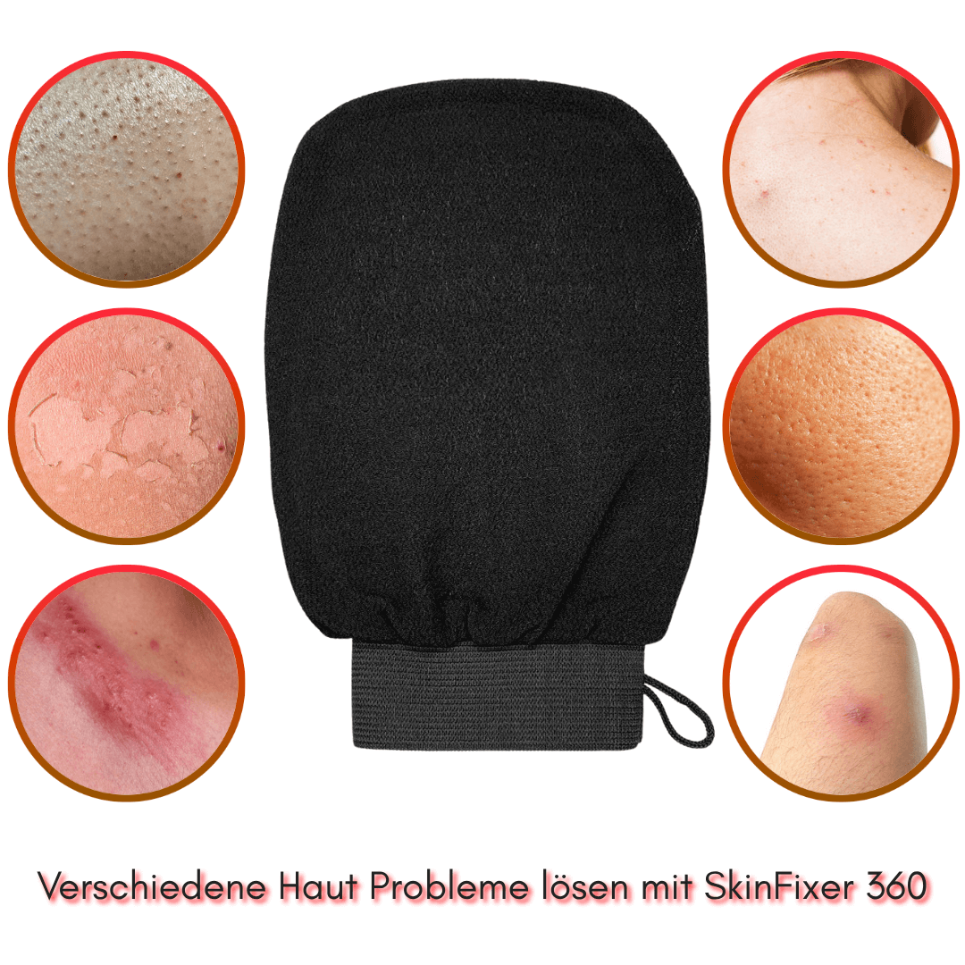 SkinFixer 360-Löst alles – 360° Perfektion